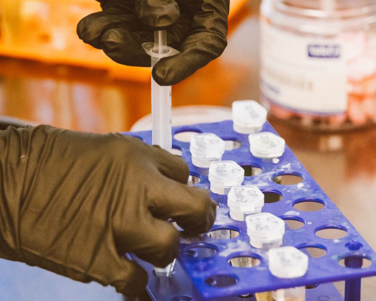 How to Test Well Water for Bacteria and Coliform: A Step-by-Step Guide